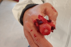 20190307_exercice_victimes_nombreuses_04